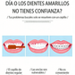 【1º en Productos para el cuidado dental】🦷✨ Limpiador Dental Ultrasónico 5 en 1 – 3 Velocidades Ajustables para Limpieza Profunda y Suave 💦📦